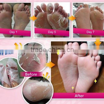 beauty mask , foot callus remover