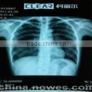 new product new Dry Thermal x-ray hot Film from china for hospital agfafilm