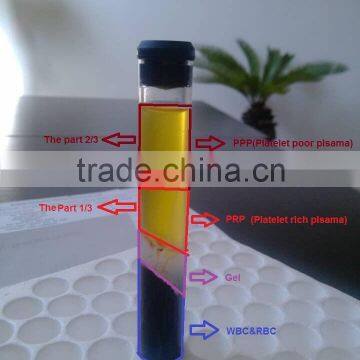 PRP Surgery PRP Tube With High Concentration Platelet 8ml,10ml,15ml photo-2