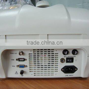 10 INCH Ultrasound Scanner RUS-6000A 3.5MHz Multi-frequency Convex Probe With 2 Probe Connector photo-2