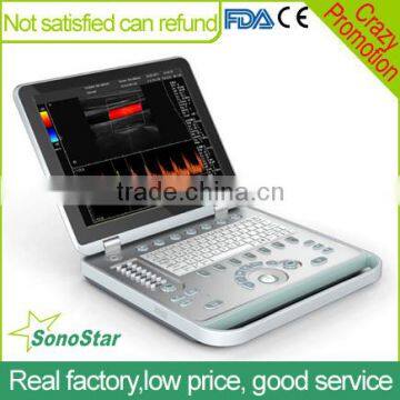 Sonostar Medical Factory Price 3D 4D Color Doppler Ultrasound Machine C5