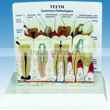 Teeth Model with Description Plate