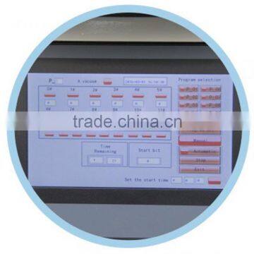 KD-TS6A Automatic Rapid Tissue Processor for Tissue Specimens Samples photo-3