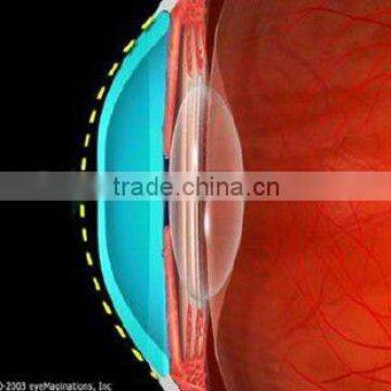 Digital Rigid MCT contact lens after Ortho-k contact lenses / Luxuriant metamorphosis of RGP Lenses,digital profession lens