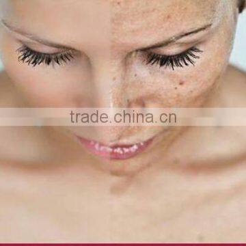 Rf Metal Tube Laser Equipment Spot Scar Pigment Removal Fractional Co2 Laser For Sale Stretch Mark Removal photo-6