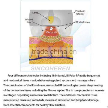 Vacuum Liposuction+Infrared Laser+Bi-polar RF+Roller Massage Body Contouring Machine photo-6