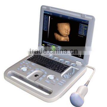 MCB-E5B 15in LCD Digital Laptop Ultrasound Scanner