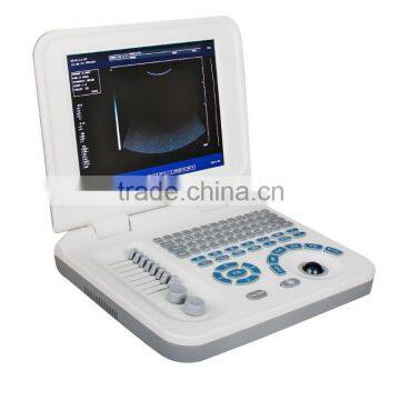 Ultrasonic, Optical, Electronic Equipments Laptop Portable B pc Based Ultrasound Scanner photo-4