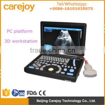 CE Approved Laptop PC platform 3D image Ultrasound Machine/Scanner with 3.5Mhz Convex probe