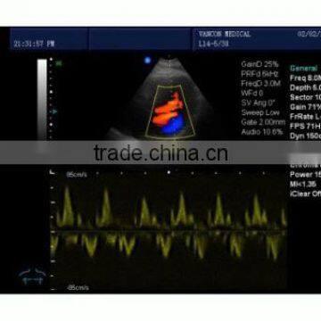 MSLCU01 Best Seller Portable Color Doppler Ultrasound in China