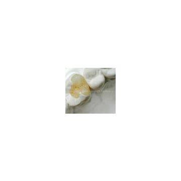 Dental Composite Inlay/Onlay Denture also has crown