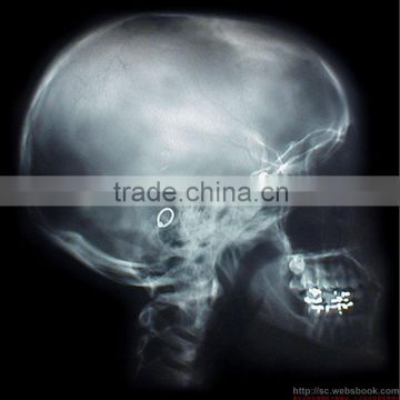 radiography film, medical x-ray film agfa for digital xray dry