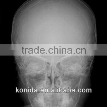 dental medical x-ray film in medical x ray equipment and accessories