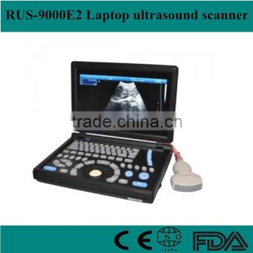 10 inch Portable/Notebook/Laptop RUS-9000E2 ultrasound Scanner/machine with convex probe, linear, vaginal, rectal transducer