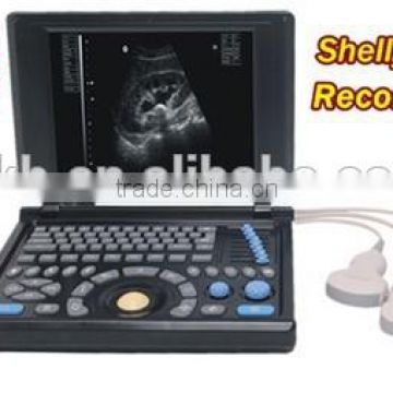 Good Image Portable/Notebook/Laptop RUS-9000E2 ultrasound Scanner/machine with convex probe, linear, vaginal, rectal transducer