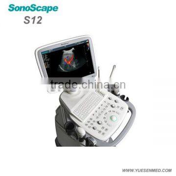 Full Digital Color Doppler Ultrasound Machine Sonoscape S12 Price photo-3