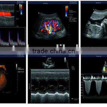 High Quality 3D Color Doppler Ultrasound Machine With Internal Report photo-3