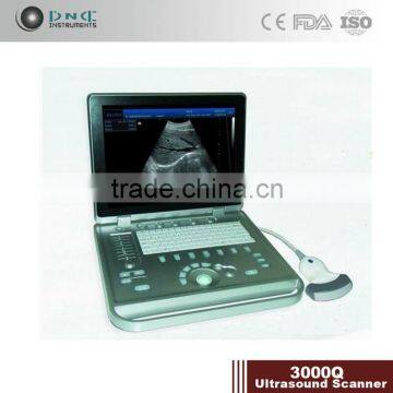 Wholesale Portable Digital High Quality Ultrasound Scanner photo-4