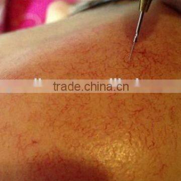 30MHz RBS ROYAL-VR360 Spider Vein Removal Machine photo-4