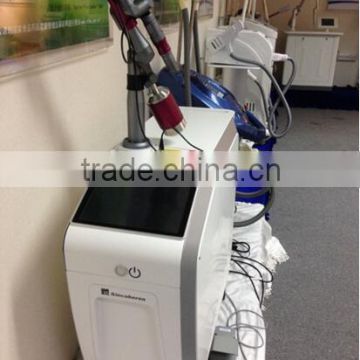 2016 High quality 1064nm 532nm q-switch ND:Yag laser tattoo