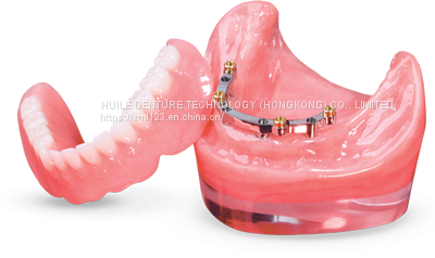 All ceramic crown Flexible Partial denture