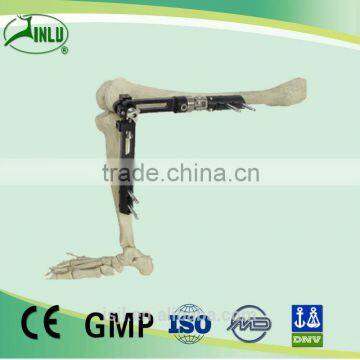 Knee Braces Bone Fracture External Fixation