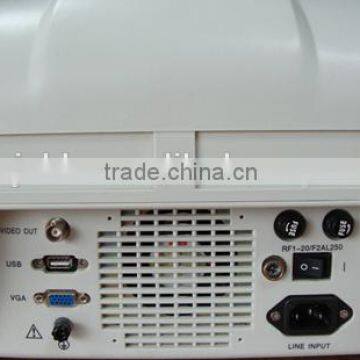 Factory Price!!CE Approved 3.5Mhz Multi-frequency Convex Probe Portable B-Mode Ultrasound Scanner System photo-3
