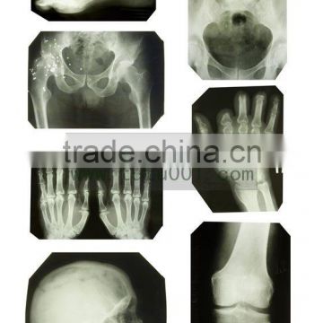 medical x-ray film, medical x-ray film agfa,CT/MRI/DR/CR/DSA film