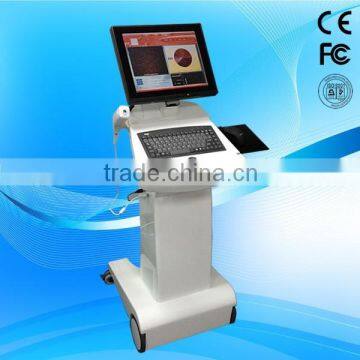 Portable Facial Machine Oxygen Jet Peel Therapy Machine Skin Texture Improvement Wrinkle Reduction System Peeling Machine For Face photo-2