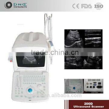 Digital Non-Interlaced portable ultrasound scanner 200D