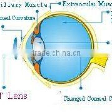 OrthoK Lens/Rigid lens/Contact lens