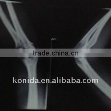 medical dry film,different from x-ray blue sensitive film