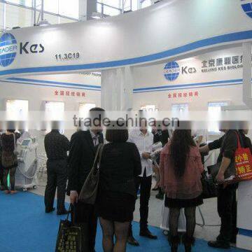 Mini q Switched Remove Freckles Tattoo Removal Yag Laser