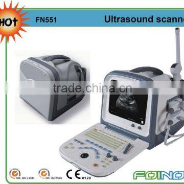 FN551 HOT selling digital ultrasonic diagnostic