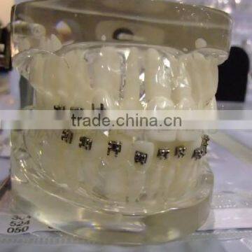 Orthodontic models/Orthodontic Models Ligature Tying Training Typodont 28 Teeth/Training Techniques Models/dental orthodontic mo