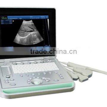 MCB-SS-9 Laptop Fully Digital Ultrasound Scanner