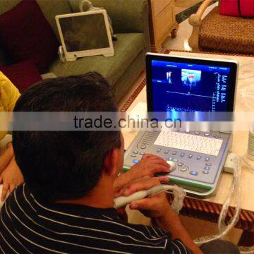 High Quality 3D Color Doppler Ultrasound Machine With Internal Report photo-2
