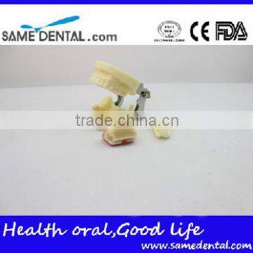 Dental Implant Practice Model DEA-31 Teeth Implant Models