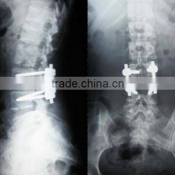 China radiografia lumbosacra KND-A/F CE