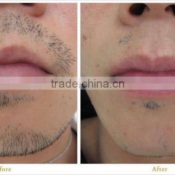 Special Design Apolomed HS-650 IPL SHR Laser Permanently Hair Removal IPL photo-5