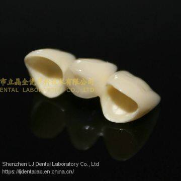 Dental Crown Zirconia PFZ, Dental Teeth, Dental Prosthesis, Laboratoire Dentaire, Dentallabor, Laboratorio Dental, Dental Laboratory, Shenzhen LJ Dental Lab China photo-5