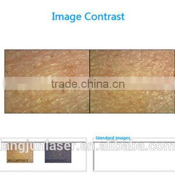 Home, Salons and Clinics Using Portable Skin Tightening Skin Analyzer photo-2