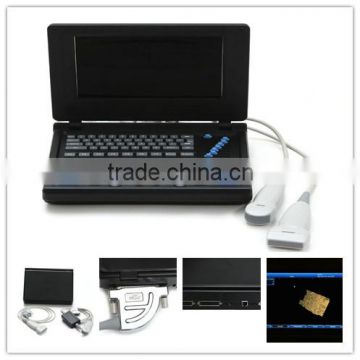 Cardiac Urology Measurement laptop Ultrasound Scanner for convex linear micro-convex transvaginal rectal probe option