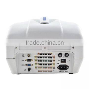 High Quality Portable Veterinary Ultrasound Equipment/portable Diagnostic Ultrasound Price photo-5