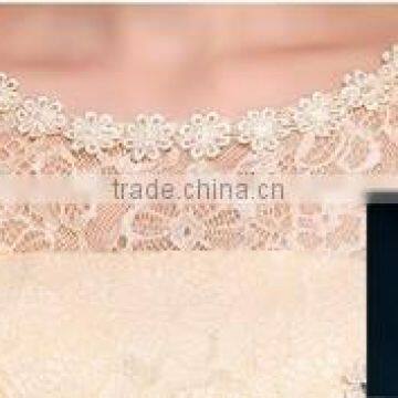 2015 Casual Cocktail Party Designer One Piece Party Dress photo-2