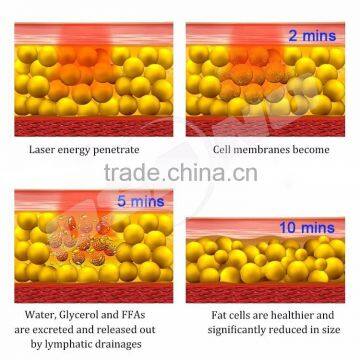 RF Vacuum Roller Machine Skin Lifting Ultrasonic Cavitation Facial Machine Price Ultrasound Weight Loss Machines photo-4