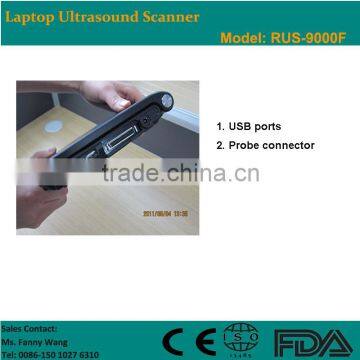 CE Approved Laptop Ultrasound Scanner/Ultrasound Machine With 3.5Mhz Multi-frequency Convex Probe RUS-9000F photo-2