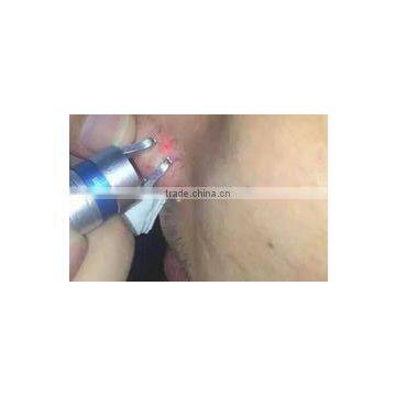 Newly Designed Spa Wanted High Frequency 980nm Laser Spider Vein Removal Machine photo-4