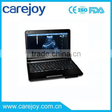 Promotion!!CE approved Laptop Ultrasound Scanner RUS-9000F with 3.5Mhz convex probe and 7.5Mhz linear probe