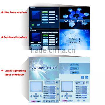 2015 Selling Manufacture of Laser Tube Laser Play System photo-4
